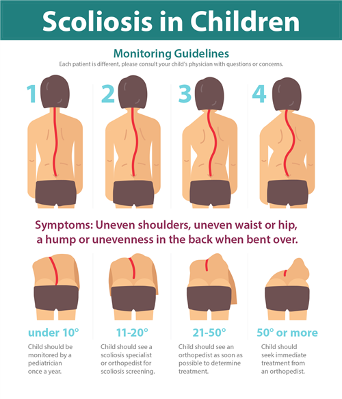 Scoliosis in Children